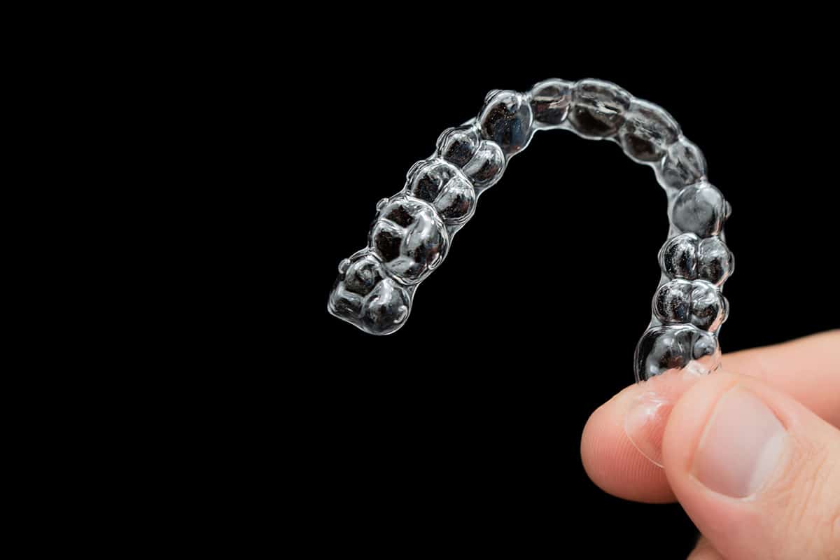 How much does invisalign cost in waimea hi blog